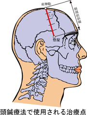頭鍼療法で使用される治療点