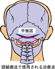 頭鍼療法　平衡区